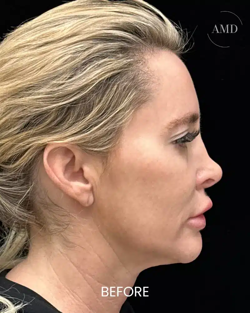 1-690cc2406328f 1 690cc2406328f