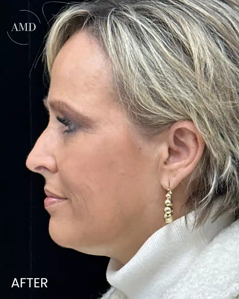 aftcase-6911f710d5fd3 aftcase 6911f710d5fd3