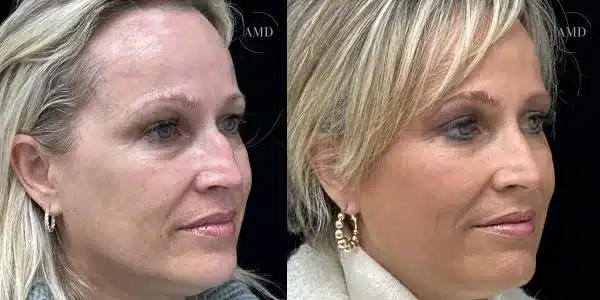 revisioncase-6910a93733811 revisioncase 6910a93733811