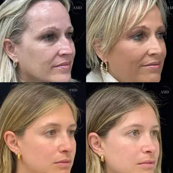 uhypll 6911fa759b686