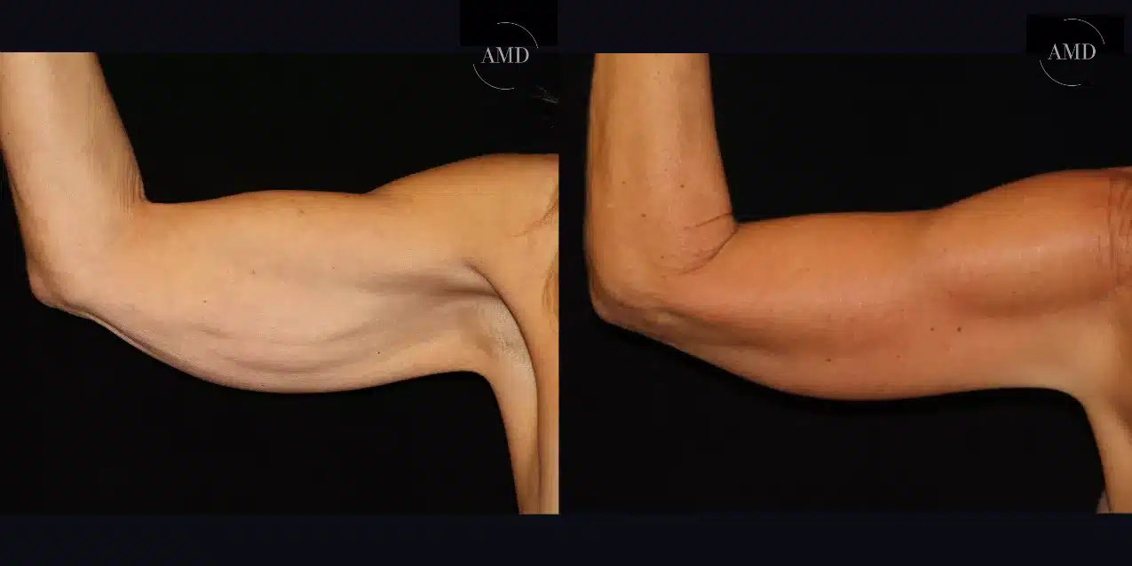 unn9090 6914be9e5dabf