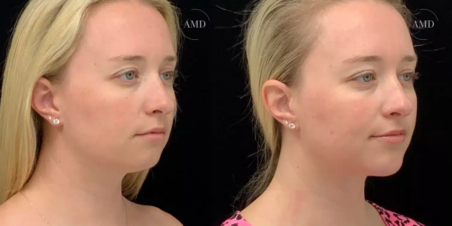 yusnw-690f550549754 yusnw 690f550549754