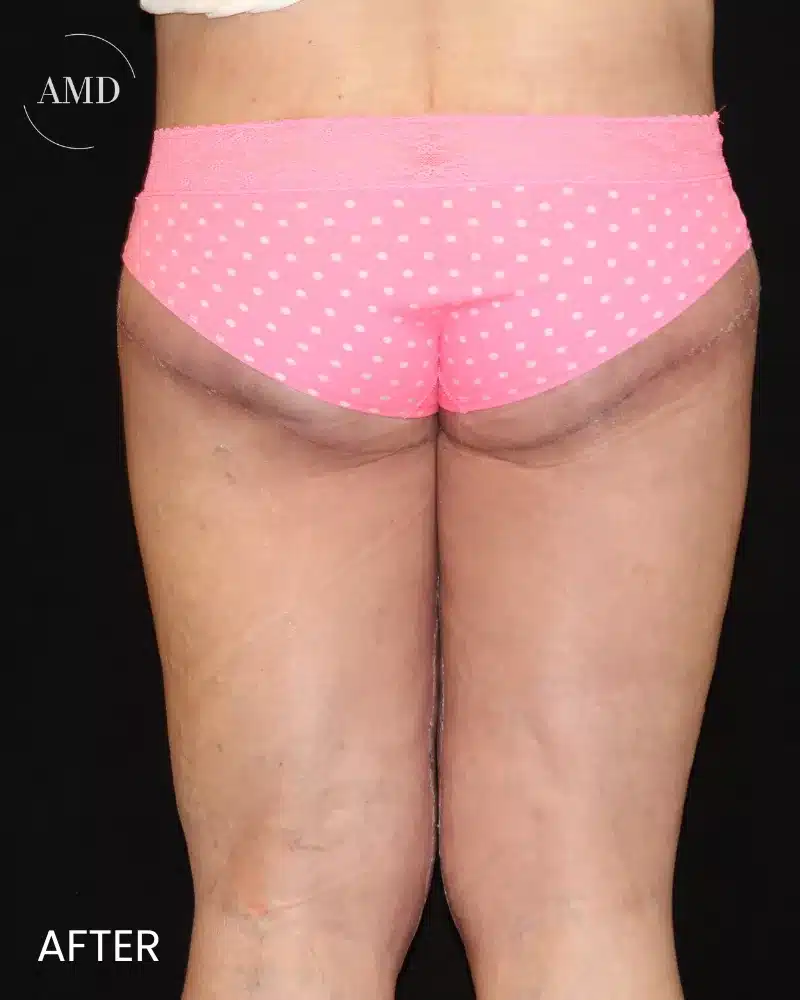 2-6931c9a0e98ad 2 6931c9a0e98ad