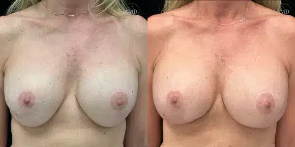 impex-6932089378ff2 impex 6932089378ff2